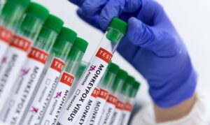 Primeiro caso de Varíola dos Macacos é confirmada no Amazonas; especialista explica sintomas da doença e maneiras de prevenção 
